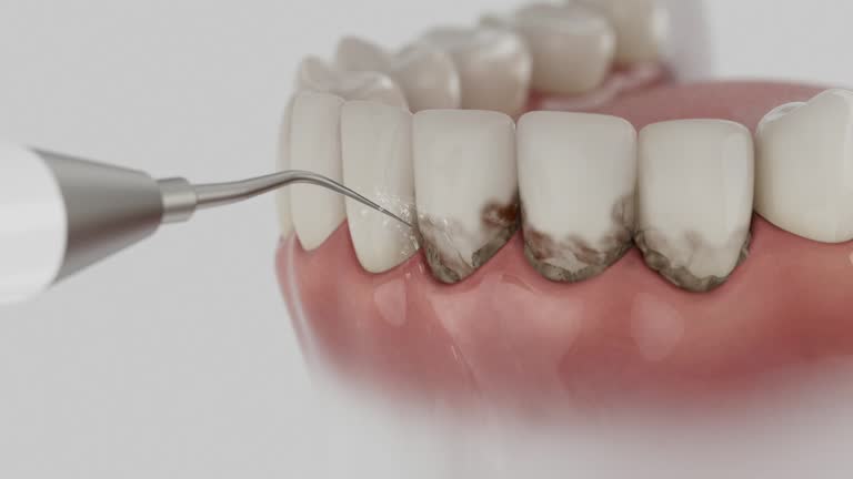 Reliable Dental contractor in Bodega Bay, CA by Smile Center Dentistry